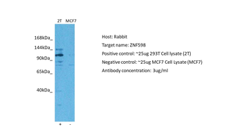 ZNF598 Rabbit Polyclonal Antibody