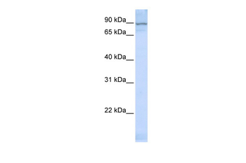 ZNF598 Rabbit Polyclonal Antibody