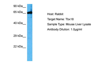 TBX18 Rabbit Polyclonal Antibody