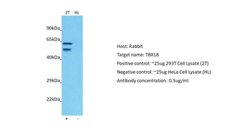 TBX18 Rabbit Polyclonal Antibody