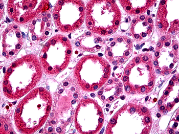 TBX18 Rabbit Polyclonal Antibody