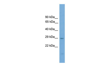 Prrx2 Rabbit Polyclonal Antibody