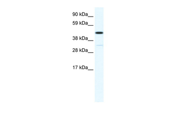 HOXA3 Rabbit Polyclonal Antibody