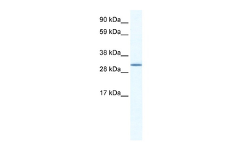 SPIC Rabbit Polyclonal Antibody