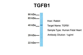 TGFB1 Rabbit Polyclonal Antibody