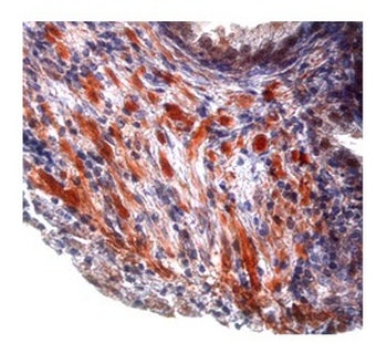 TGFB1 Rabbit Polyclonal Antibody
