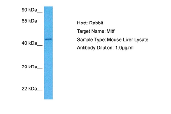 MITF Rabbit Polyclonal Antibody