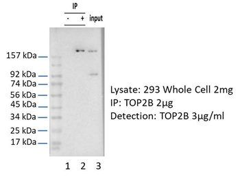 TOP2B Rabbit Polyclonal Antibody