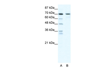 PRDM1 Rabbit Polyclonal Antibody