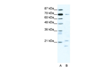 BTF3 Rabbit Polyclonal Antibody
