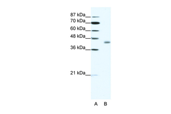 LDB2 Rabbit Polyclonal Antibody