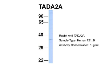 TADA2L Rabbit Polyclonal Antibody