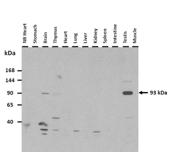 HIF1A Rabbit Polyclonal Antibody
