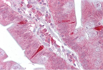 Atf4 Rabbit Polyclonal Antibody