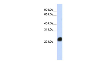 HMGB1 Rabbit Polyclonal Antibody