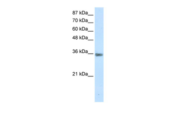MNAT1 Rabbit Polyclonal Antibody