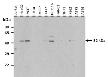 IRF4 Rabbit Polyclonal Antibody