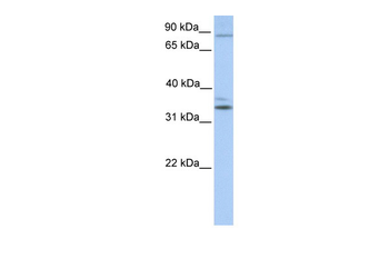 NPAS2 Rabbit Polyclonal Antibody