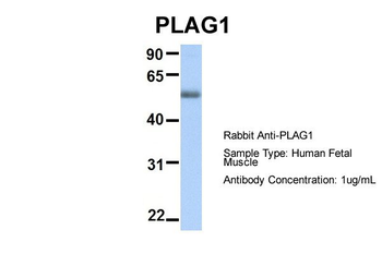 PLAG1 Rabbit Polyclonal Antibody