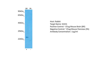 SIAH1 Rabbit Polyclonal Antibody