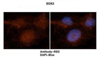 SOX2 Rabbit Polyclonal Antibody