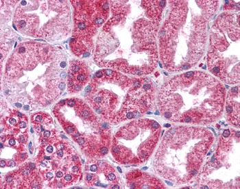 STAT3 Rabbit Polyclonal Antibody