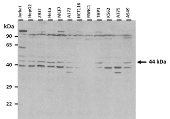 TEAD4 Rabbit Polyclonal Antibody