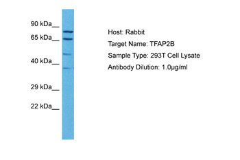 TFAP2B Rabbit Polyclonal Antibody