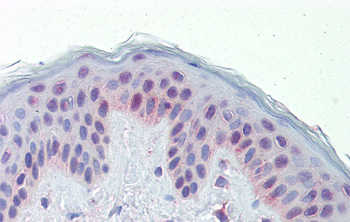 NR2C1 Rabbit Polyclonal Antibody