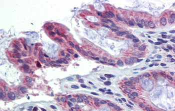 TULP2 Rabbit Polyclonal Antibody