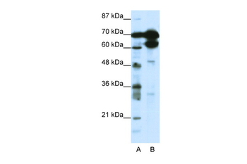 ZNF76 Rabbit Polyclonal Antibody