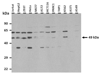TEAD2 Rabbit Polyclonal Antibody