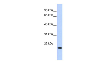 IRF7 Rabbit Polyclonal Antibody