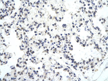 TRIP13 Rabbit Polyclonal Antibody