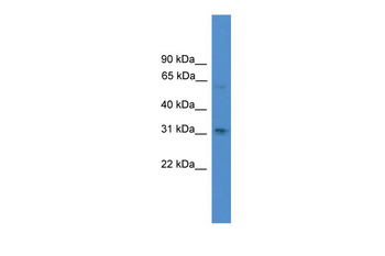 RUNX2 Rabbit Polyclonal Antibody