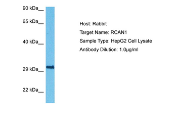 RCAN1 Rabbit Polyclonal Antibody