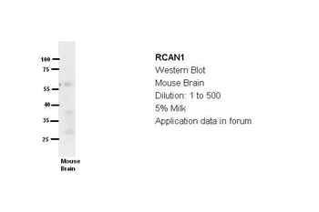 RCAN1 Rabbit Polyclonal Antibody