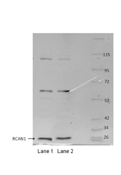 RCAN1 Rabbit Polyclonal Antibody