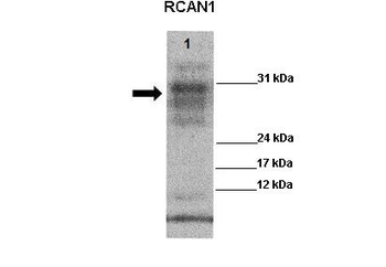 RCAN1 Rabbit Polyclonal Antibody