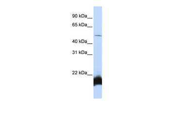 ONECUT1 Rabbit Polyclonal Antibody