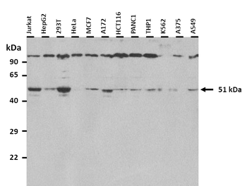 ONECUT1 Rabbit Polyclonal Antibody
