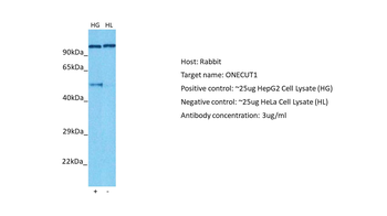 ONECUT1 Rabbit Polyclonal Antibody