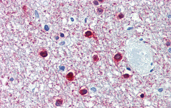 ONECUT1 Rabbit Polyclonal Antibody