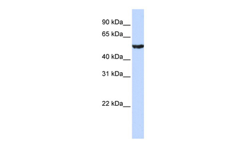 ONECUT1 Rabbit Polyclonal Antibody