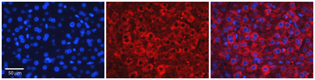 ZFP36L1 Rabbit Polyclonal Antibody