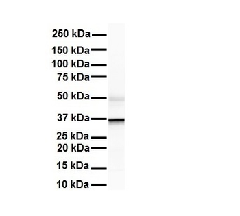 ZFP36L1 Rabbit Polyclonal Antibody