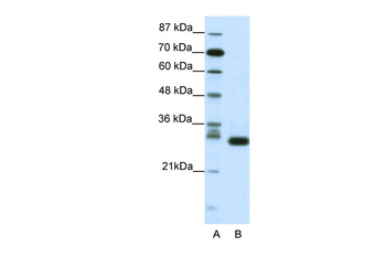 CDK5 Rabbit Polyclonal Antibody