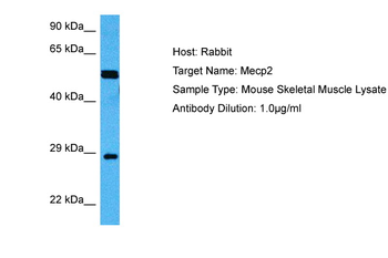MECP2 Rabbit Polyclonal Antibody
