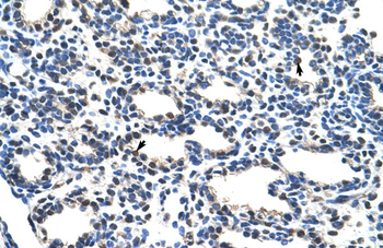 NRF1 Rabbit Polyclonal Antibody