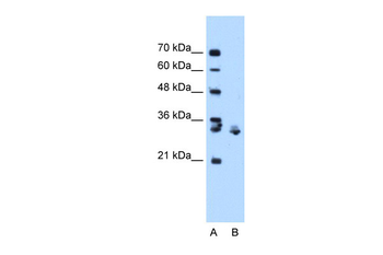 XBP1 Rabbit Polyclonal Antibody